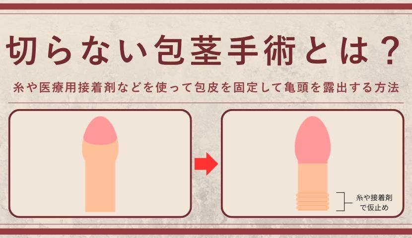切らない包茎手術とは？